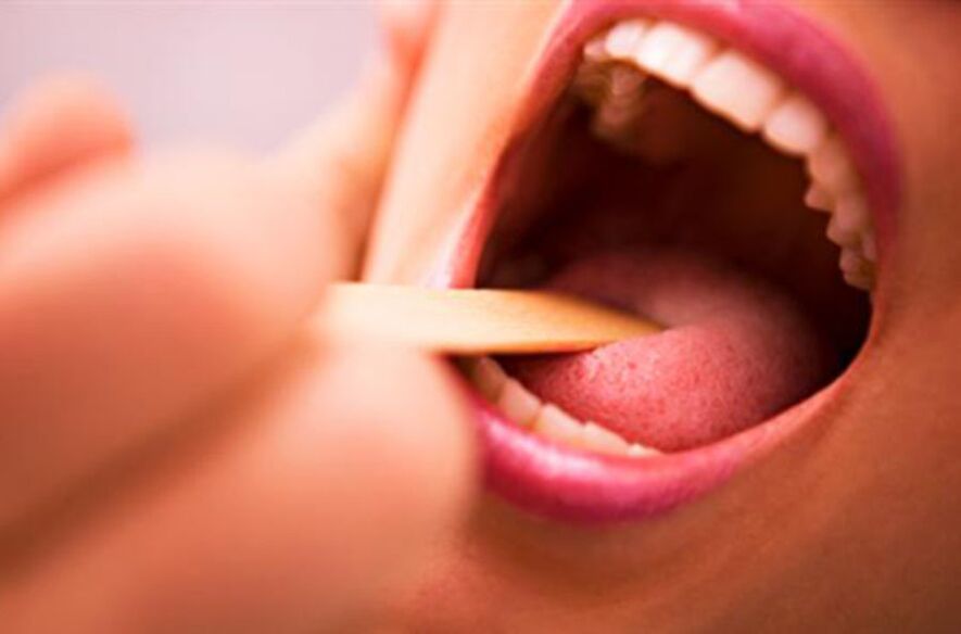 các loại ký sinh trùng trong miệng con người